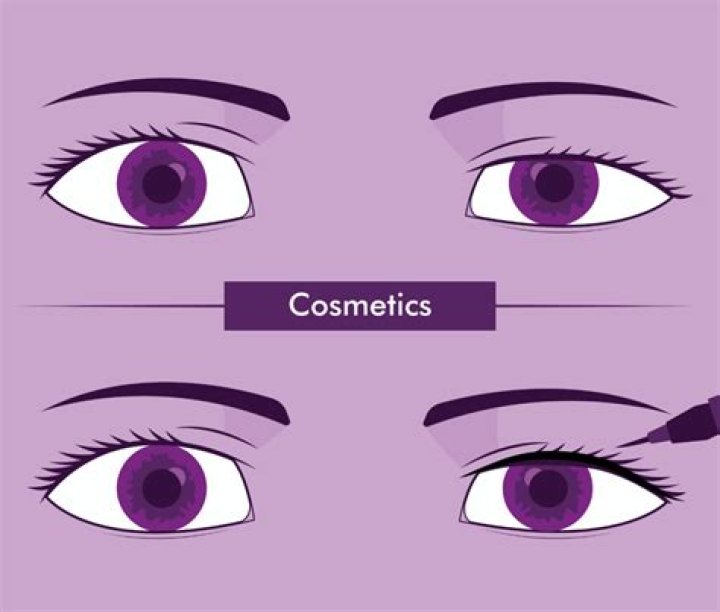 Asymmetrical Eyelids: Understanding Causes, Treatments, and Solutions