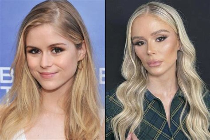 Bianca Censori Plastic Surgery Before and After: Journey to Beauty