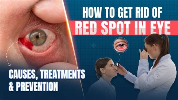 Red Blister Under Eye: Causes, Symptoms, Treatments, and Prevention